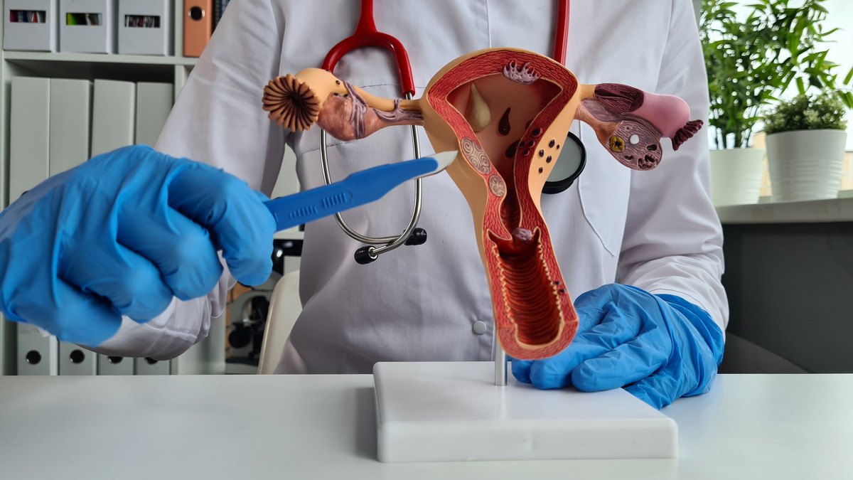 Medic explică pe un model anatomic al uterului cum decurge histeroscopia
