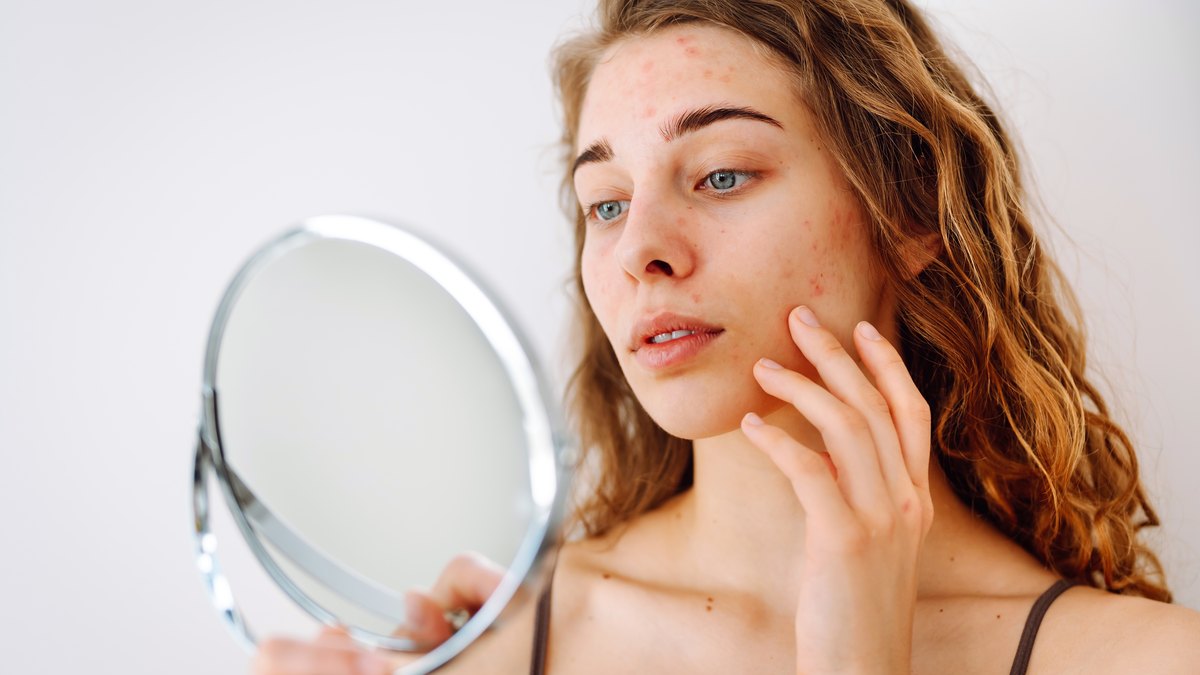 Cicatrici post-acneice, vergeturi, piele lăsată sau căderea părului au soluție: Dermapen 4