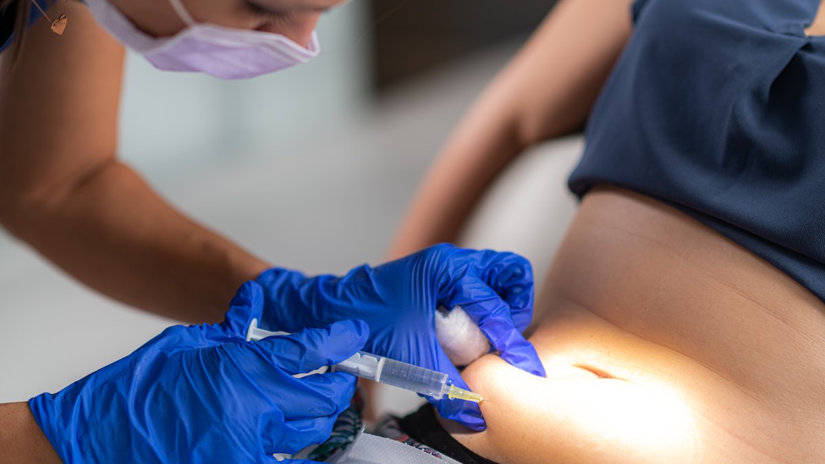 Bărbie dublă, aripioare și abdomen - cum scapi fără chirurgie de grăsimea localizată, cu lipoliză injectabilă