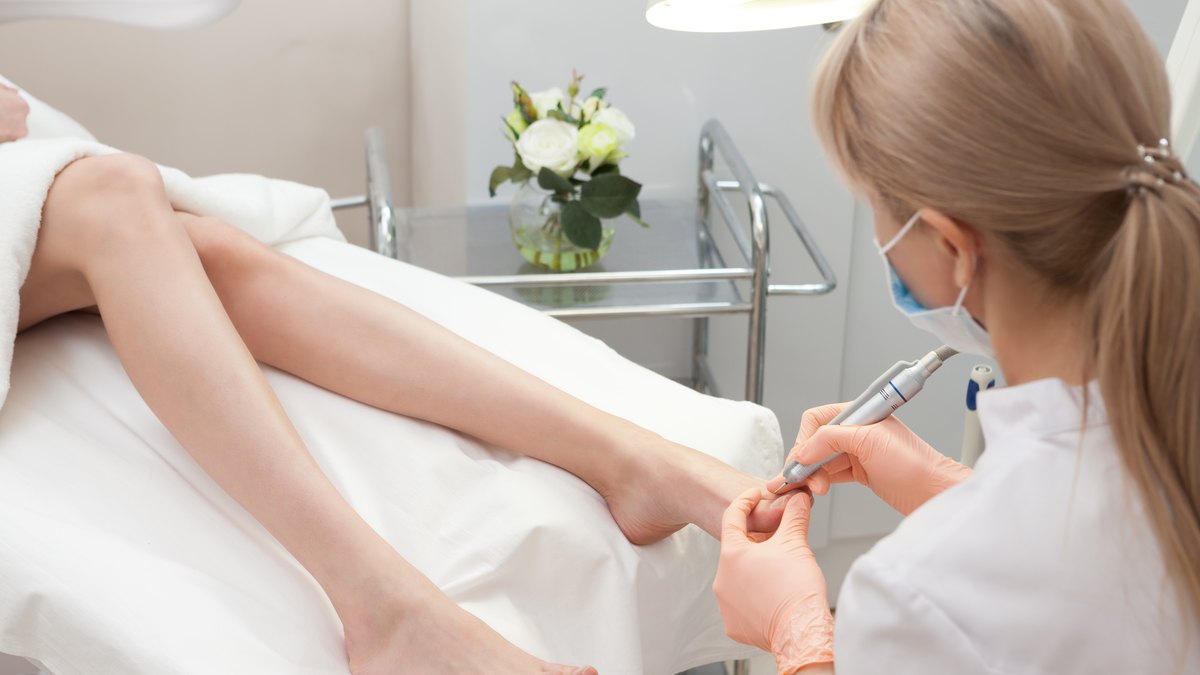 Unghie îngroșată, gălbuie și sfărâmicioasă - poate fi onicomicoză, iar când tratamentele clasice nu rezolvă, laserul face diferența