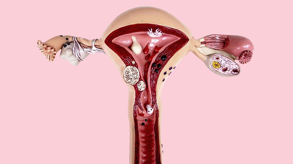 Cancer de col uterin în România - 6 femei mor zilnic, deși boala este 100% tratabilă dacă este găsită la timp. Cum se depistează precoce